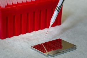stop common diseases, lab tests